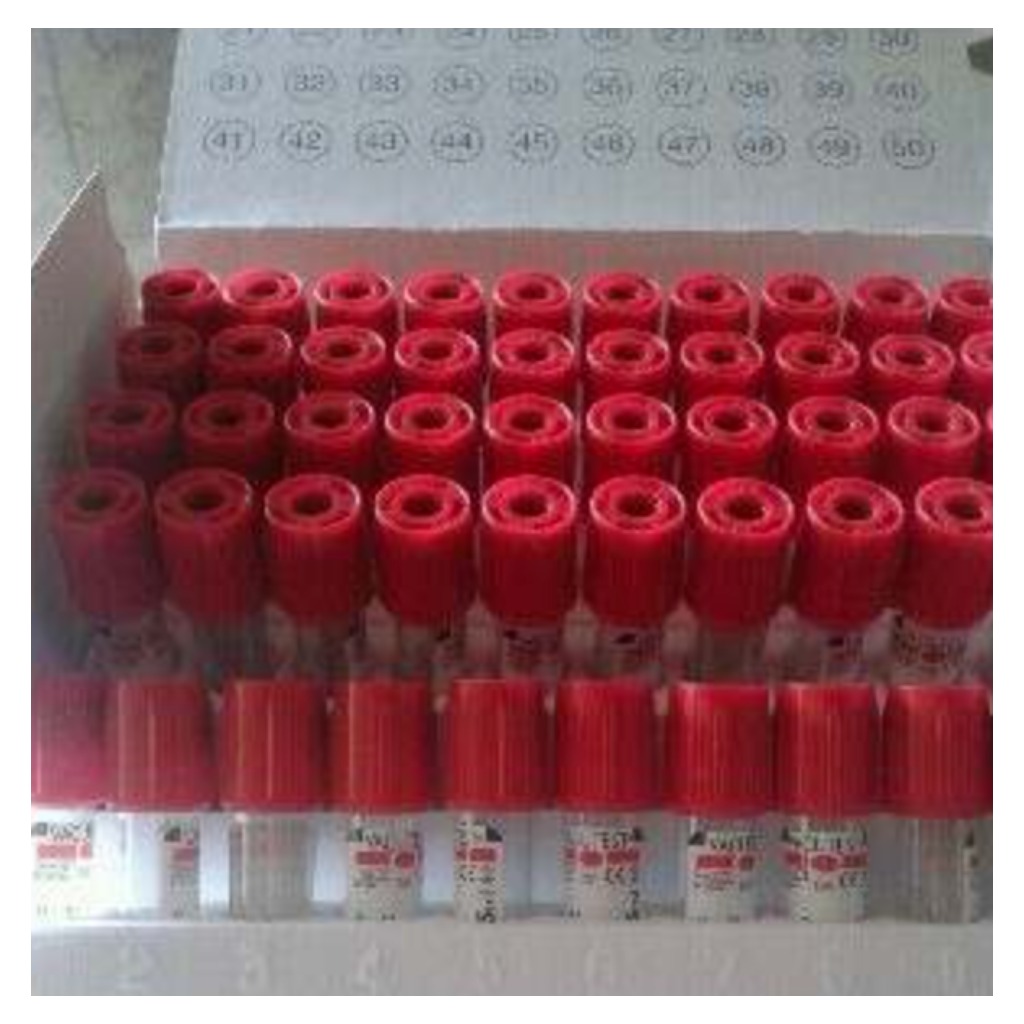 Tubetti Vacutest da 4,5 ml - 50 unità
